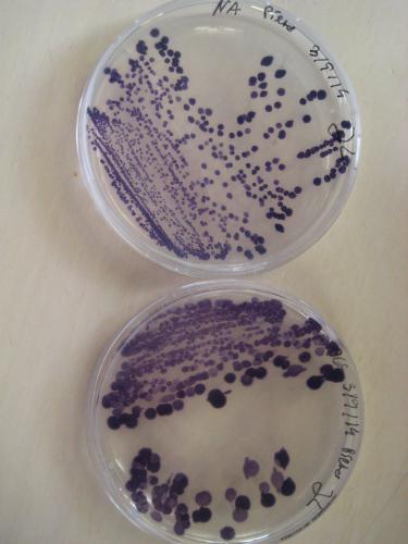 janthinobacterium lividum